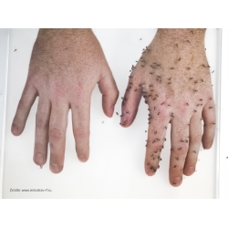 Repelent spray Mugga 9,5% DEET 75 ml