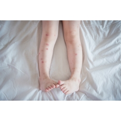 Repelent spray Mugga 9,5% DEET 75 ml